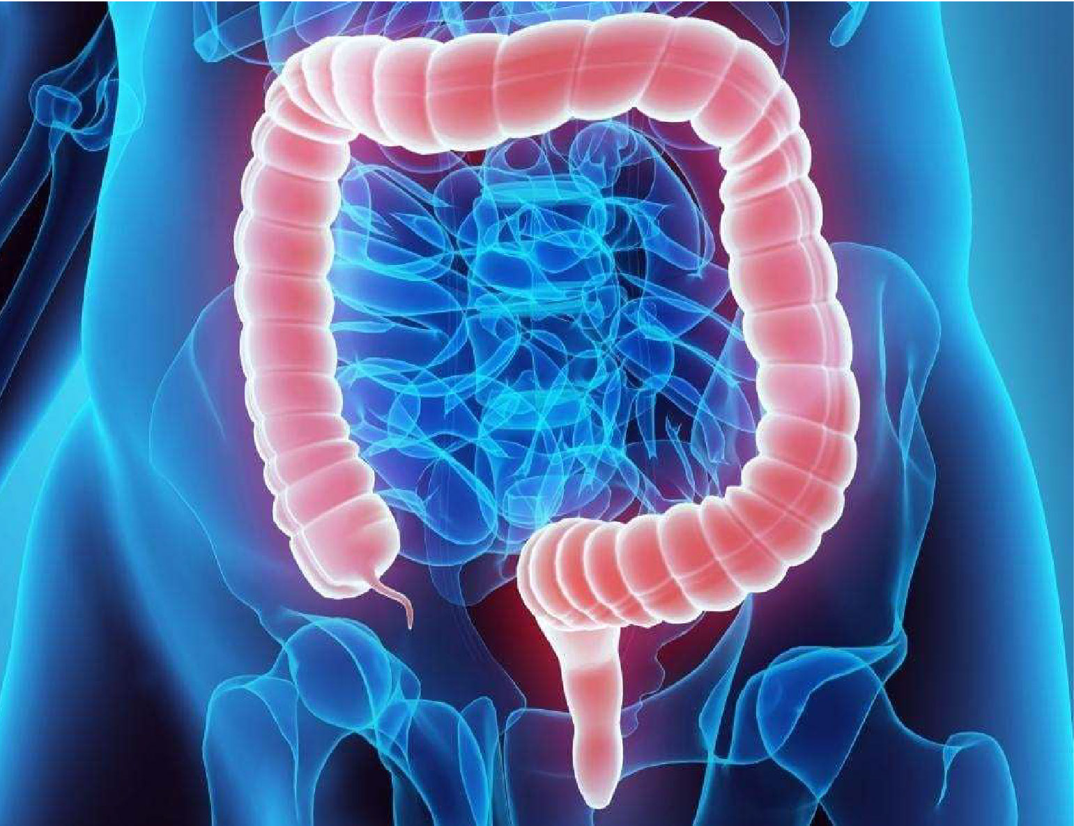 incidence of colorectal
